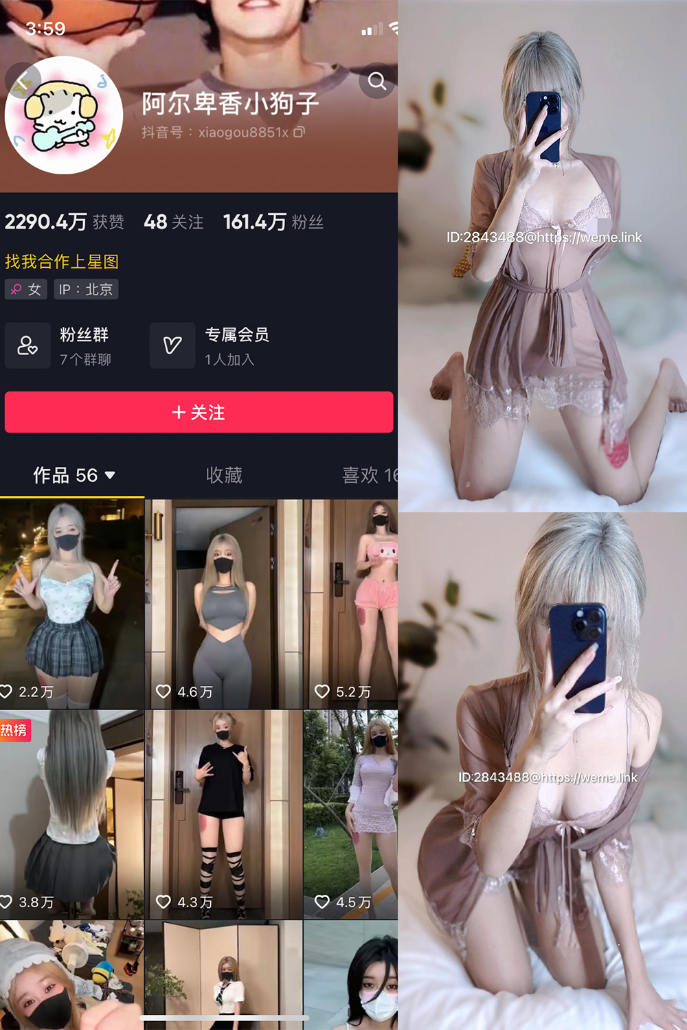 抖音 阿尔卑香小狗子 微密圈  NO.045期 【39P】最新至：2026.6.9-微密圈